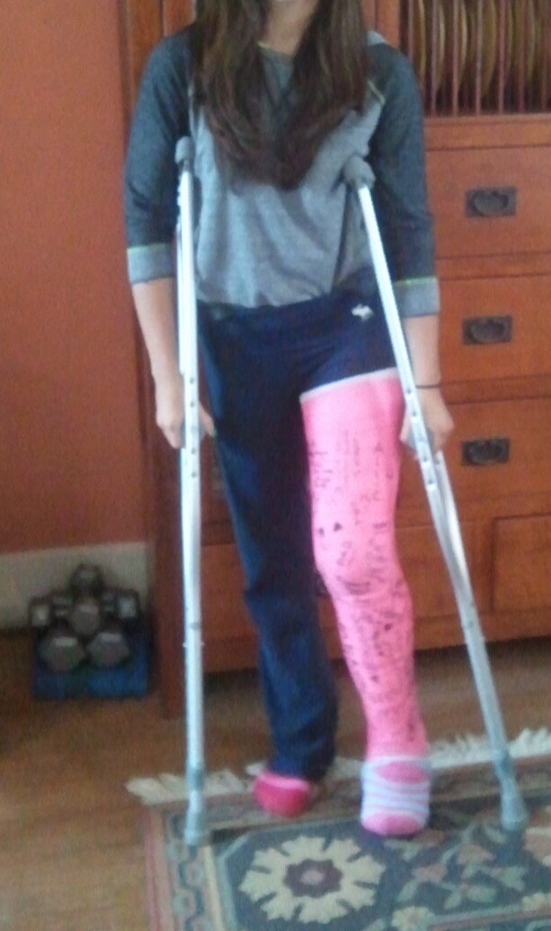 Casts and Toes Couple of Nice Full Leg Casts