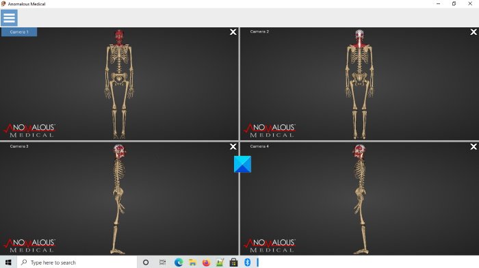 Software médico anómalo de anatomía humana