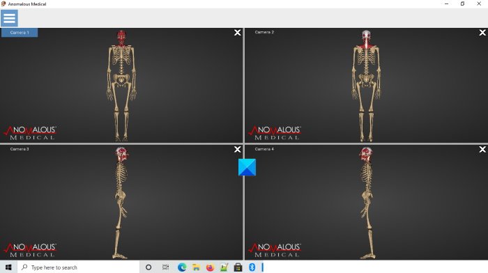 Logiciel d'anatomie humaine médicale anormale