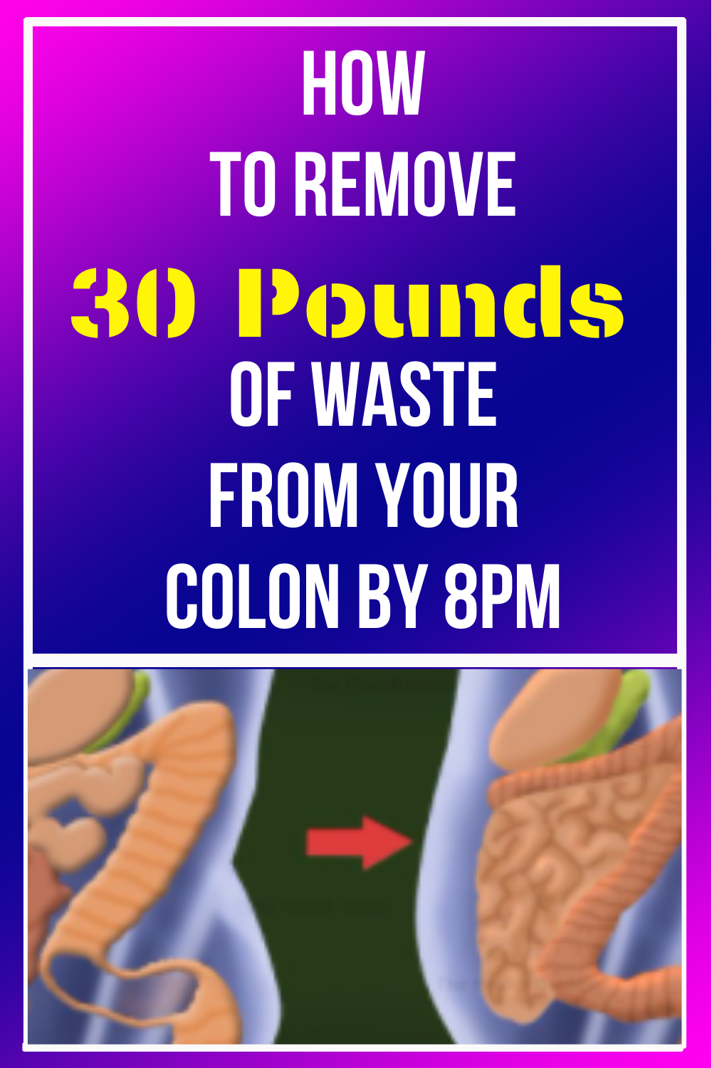 How Many Pounds Of Waste Can Your Intestines Hold How To Remove 30 Pounds Of Waste From Your Colon By 8PM