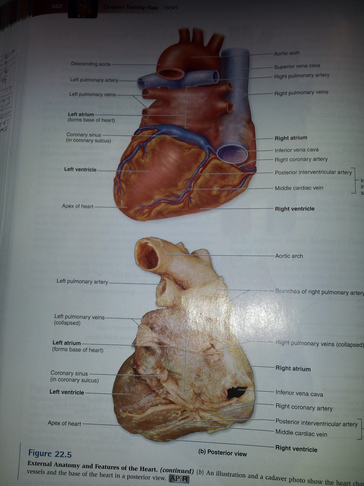 Absorbing what I can: The Human Heart