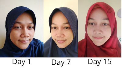 before after pemakaian vita milky strawberry