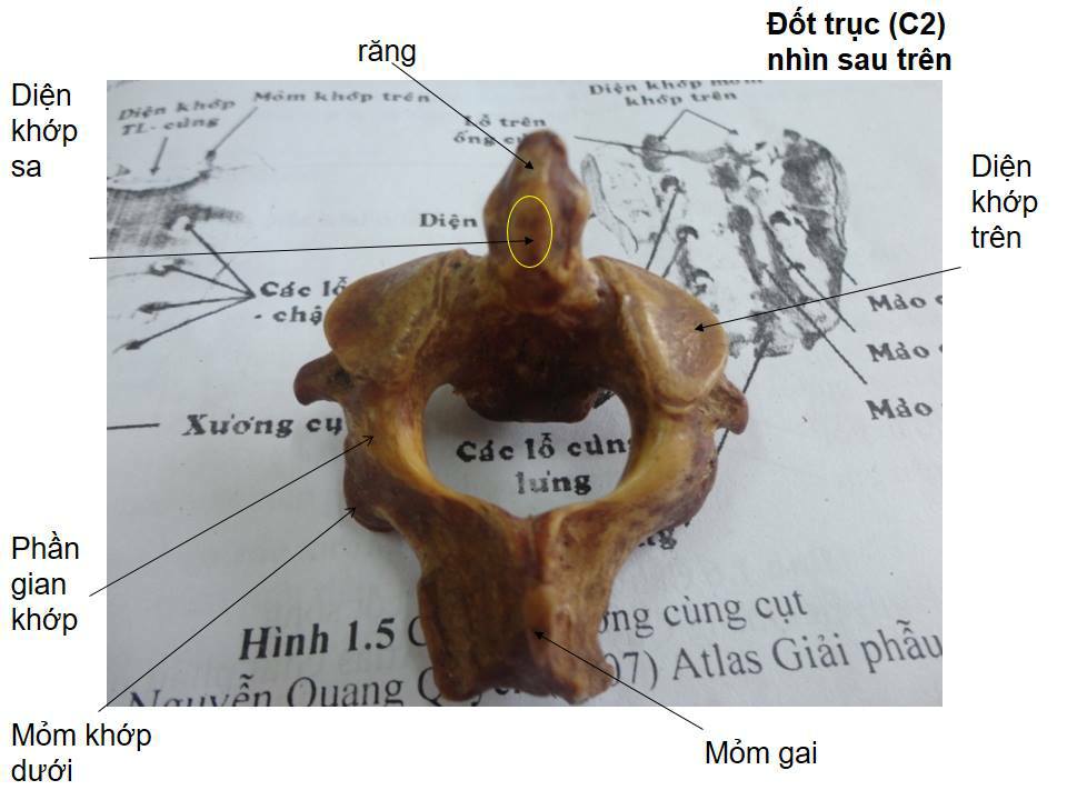 Hình ảnh giải phẫu (phần 2) - phần xương đốt sống | Diễn đàn Y Dược Trà ...