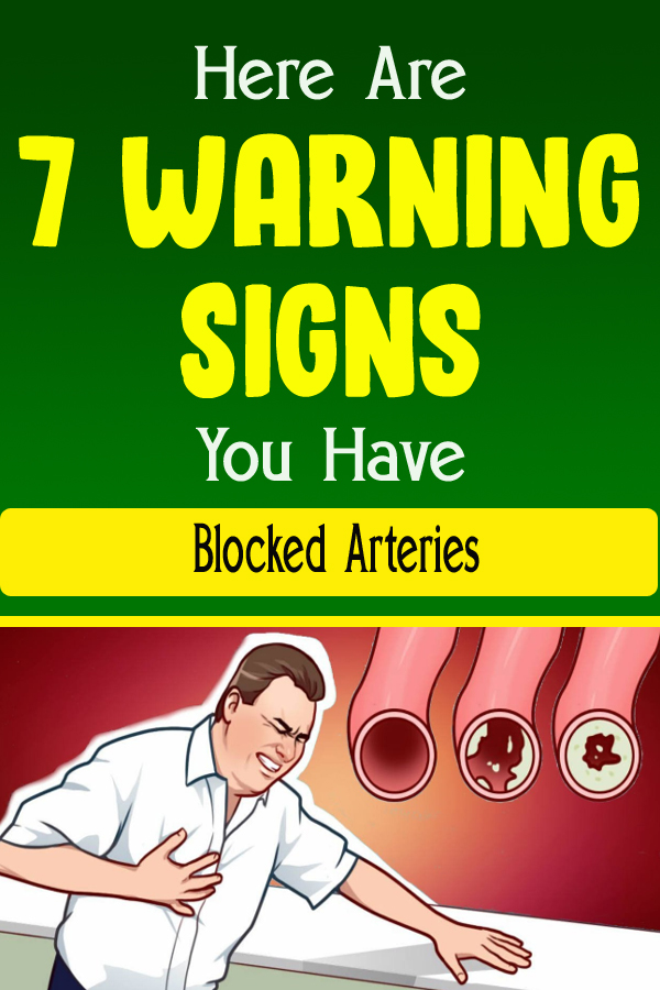 Here Are 7 Warning Signs You Have Blocked Arteries