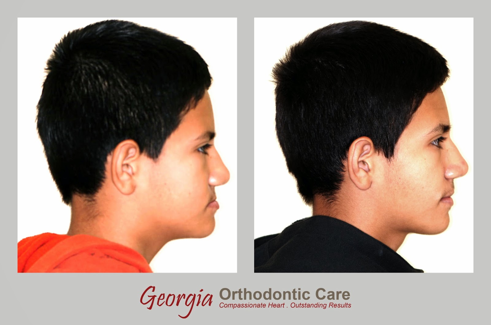 ORTHODONTIC CARE LAWRENCEVILLE & NORCROSS GA December 2014