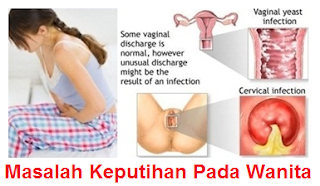 Resep Obat Keputihan Gatal Bau Paling Ampuh Resep Obat Keputihan Gatal Bau Paling Ampuh