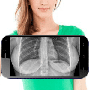 Aplikasi Tembus Pandang X-Ray Body Scanner Camera