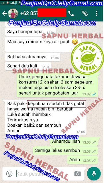 Obat Keputihan Berwarna Hijau, Jernih, Coklat, Kuning, Abu-abu, Dan Putih Susu Obat Keputihan Berwarna Hijau, Jernih, Coklat, Kuning, Abu-abu, Dan Putih Susu