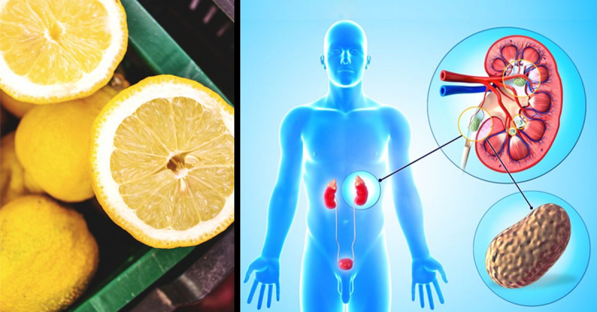 A Simple Way To Cleanse Your Kidneys With Lemon