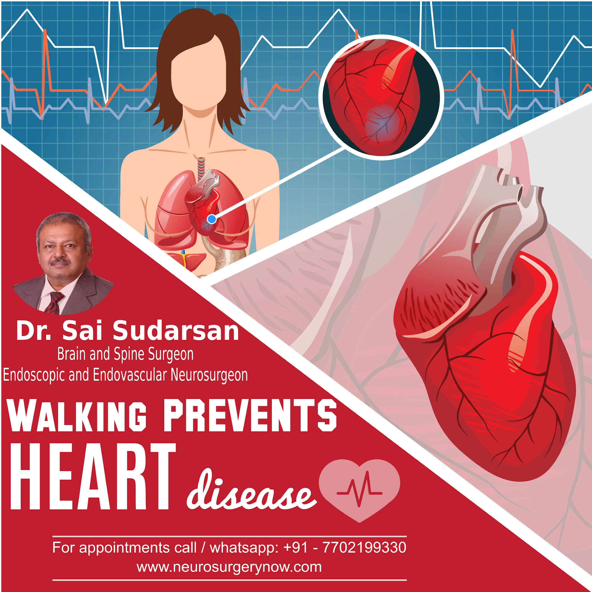 Walking Prevents Heart Disease