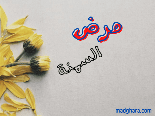 الشاي الأخضر ونقص زيادة الوزن (مرض السمنة)