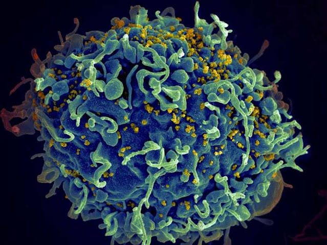 A human T lymphocyte (blue) attacked by HIV (yellow), the virus that causes AIDS. The virus specifically targets T cells, which play an essential role in the body's immune response against invaders such as bacteria and viruses. Seth Pincus, Elizabeth Fischer and Austin Athman, National Institute of Allergy and Infectious Diseases / NIH