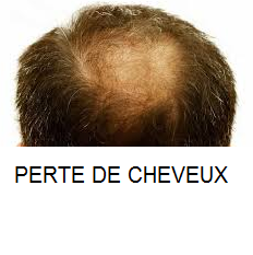Les masques pour la croissance des cheveu pour une nuit