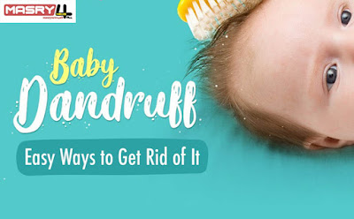 علاج قشرة الشعر عند الأطفال والتخلص النهائي منها   Treatment of dandruff in children