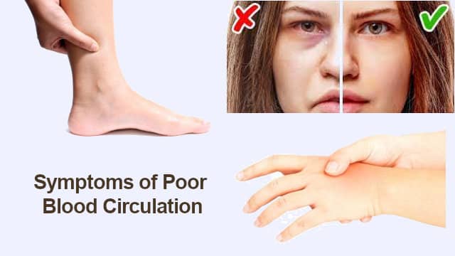 Symptoms of Poor Blood Circulation in Legs Hands and Face