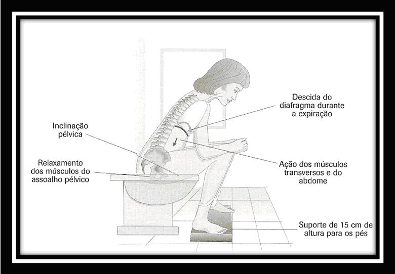 Dicas de saúde para prevenção de disfunções no assoalho pélvico