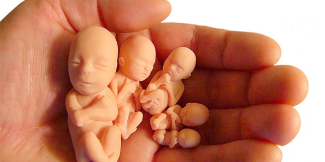 AYDINLANMA KÜRTAJ; CİNAYET Mİ HAK MI