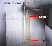 Urine Microscopic - Test