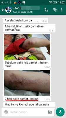 cara menghilangkan bekas luka