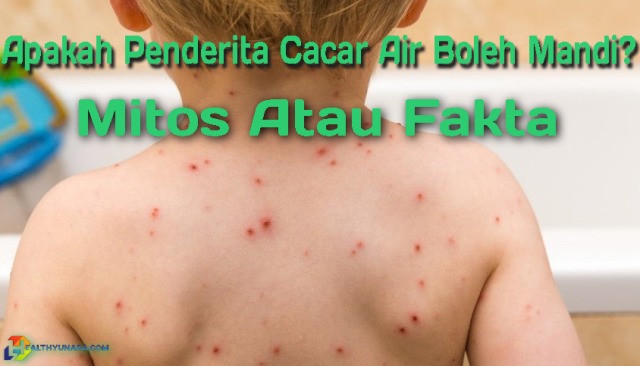 Apakah Penderita Cacar Air Boleh Mandi? Apakah Penderita Cacar Air Boleh Mandi? Mitos Atau Fakta