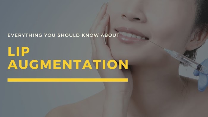 Everything You Should Know about Successful Lip Augmentation Treatment