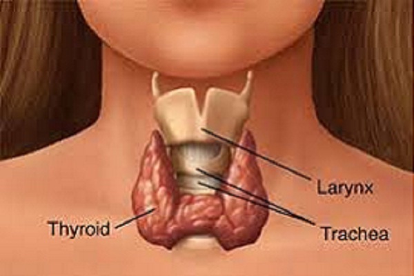 Gondok adalah kondisi ketika terdapat benjolan di bagian leher akibat kelenjar tiroid yang membesar