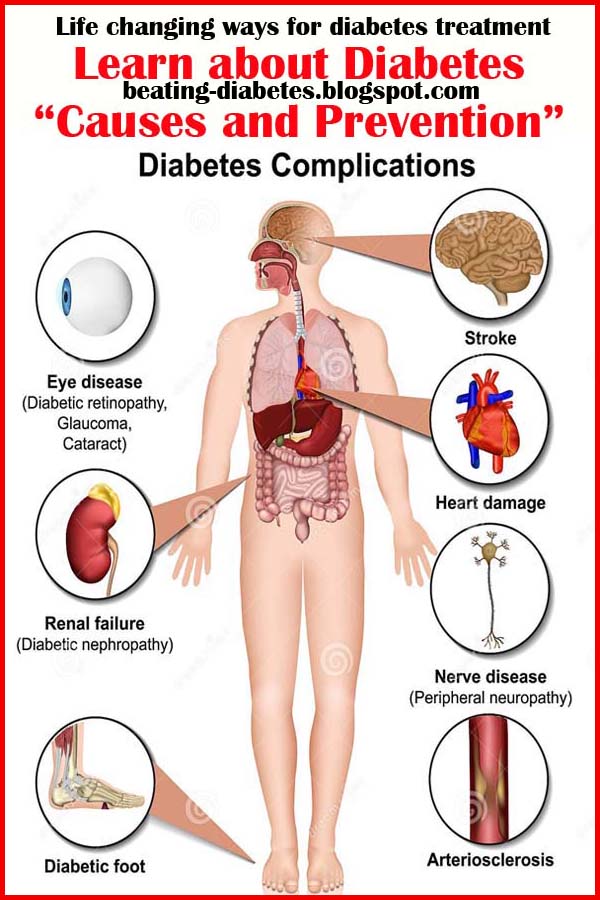 The Best Way to Keep Diabetes out Of Your Life Either you have it or