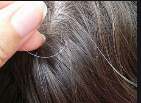 Hair Tips 2020 Disadvantages Of Plucking The White Hair What