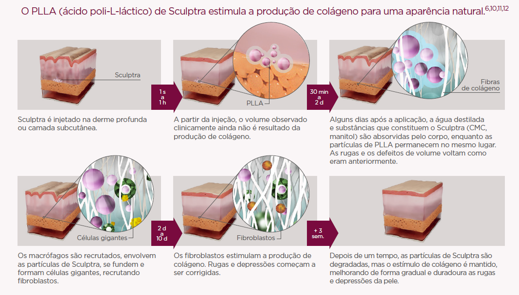 Sculptra® chega ao Brasil para inovar o processo de reposição de
