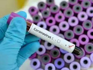COVID-19: 24 घंटे में मिले कोरोना के 27 मरीज, तीन दिन में ही 96 से 170 पहुंच गया आंकड़ा, 18 जिलों में फैला दायरा COVID-19: 24 घंटे में मिले कोरोना के 27 मरीज, तीन दिन में ही 96 से 170 पहुंच गया आंकड़ा, 18 जिलों में फैला दायरा