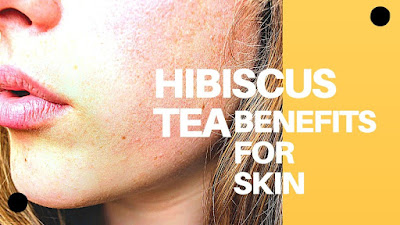 buy hibiscus tea online