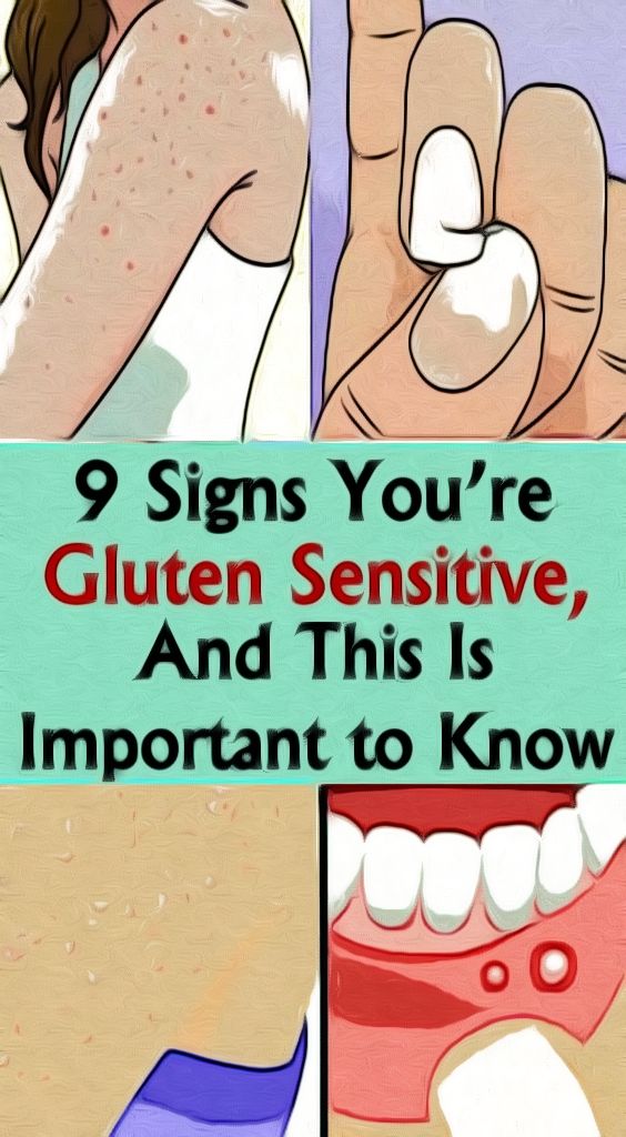 9 Signs You’re Gluten Sensitive, and This Is Important to Know