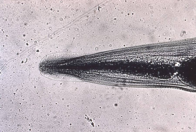 human-pinworm