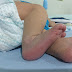 Bebê abandonado em porta de igreja é encontrado por padre no município de Barro CE