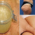 LUNASI STRETCH MARK DAN SELULIT MU DENGAN BAHAN ALAMI INI..!! MUDAH DIBUAT DAN TERBUKTI KHASIATNYA...,!!!