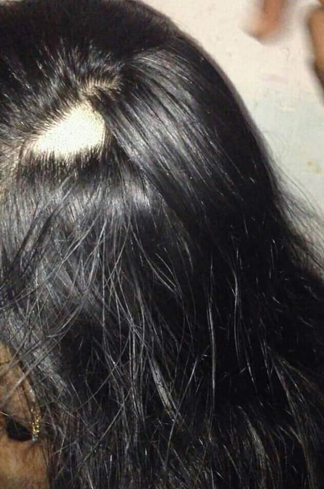 Village Barber Stories Home made head shaving for removing Dandruff