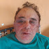Candidato a prefeito de Santa Terezinha, PB, é agredido durante assalto em fazenda da família