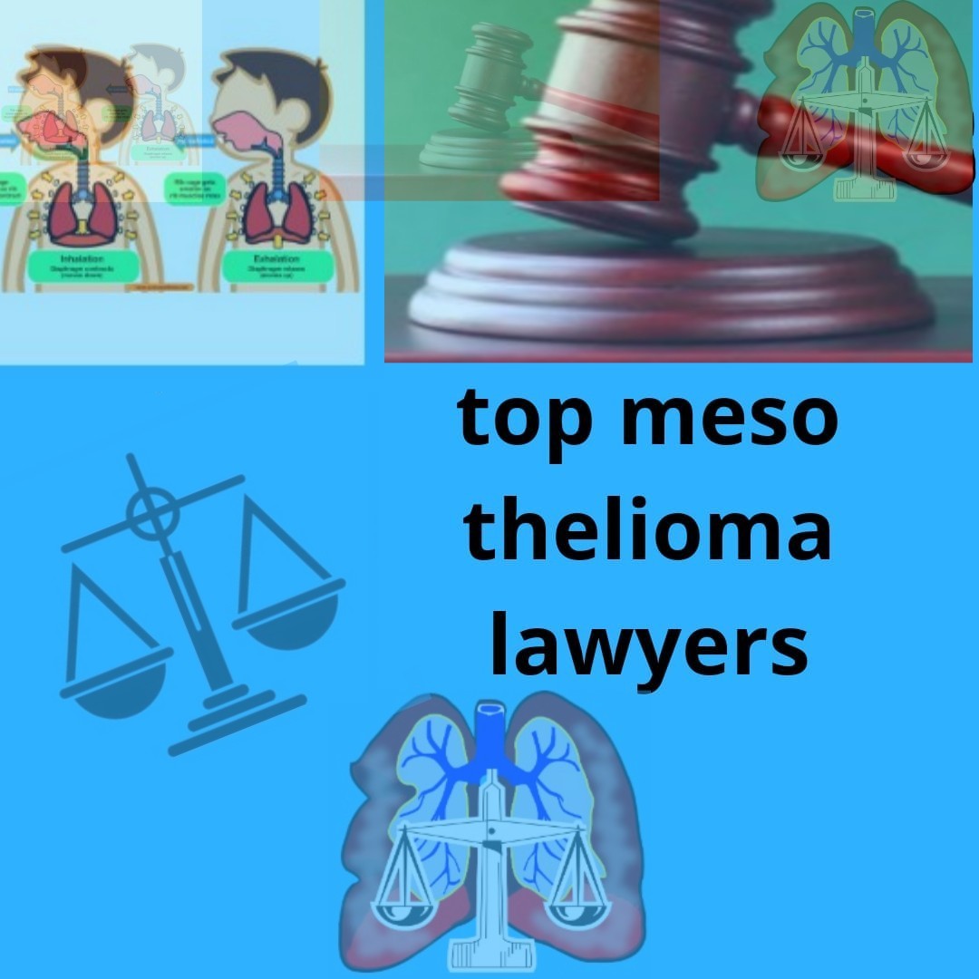 Top mesothelioma lawyers Top mesothelioma lawyers