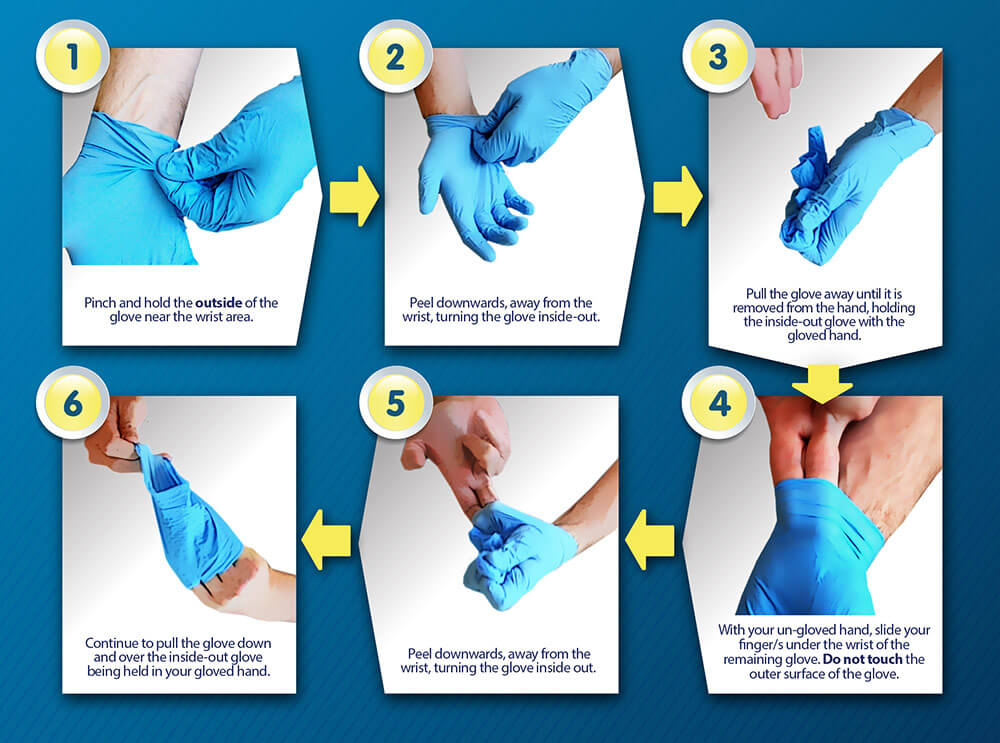 Medidas De Prevenci n Frente A ITS En El Personal De Salud Guantes medidas-de-prevenci-n-frente-a-its-en-el-personal-de-salud-guantes