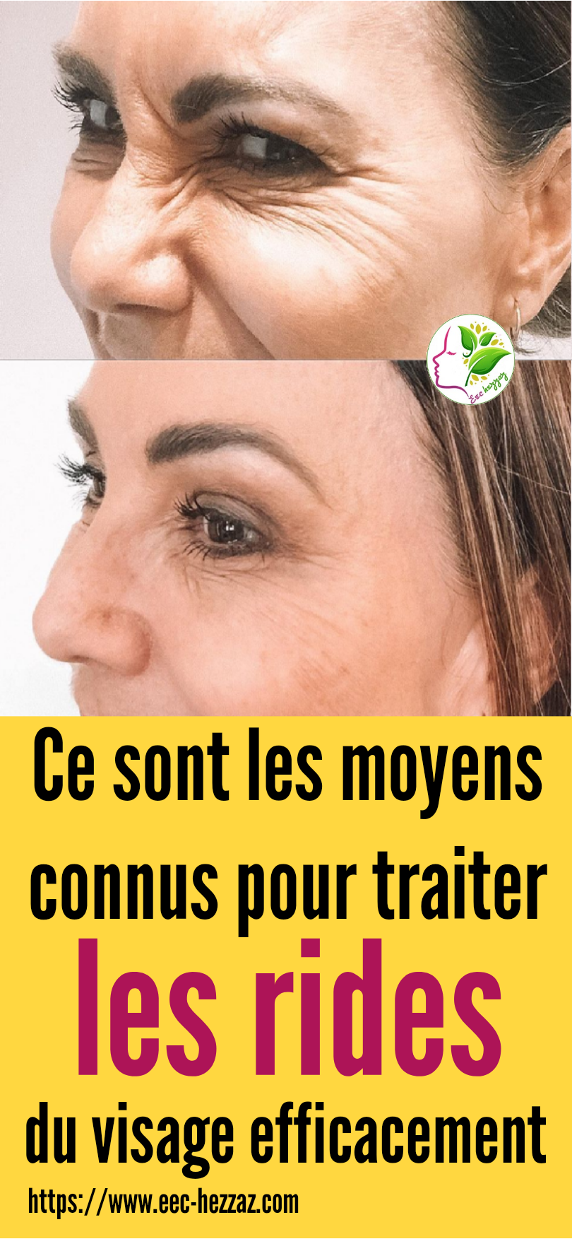 Ce sont les moyens connus pour traiter les rides du visage efficacement