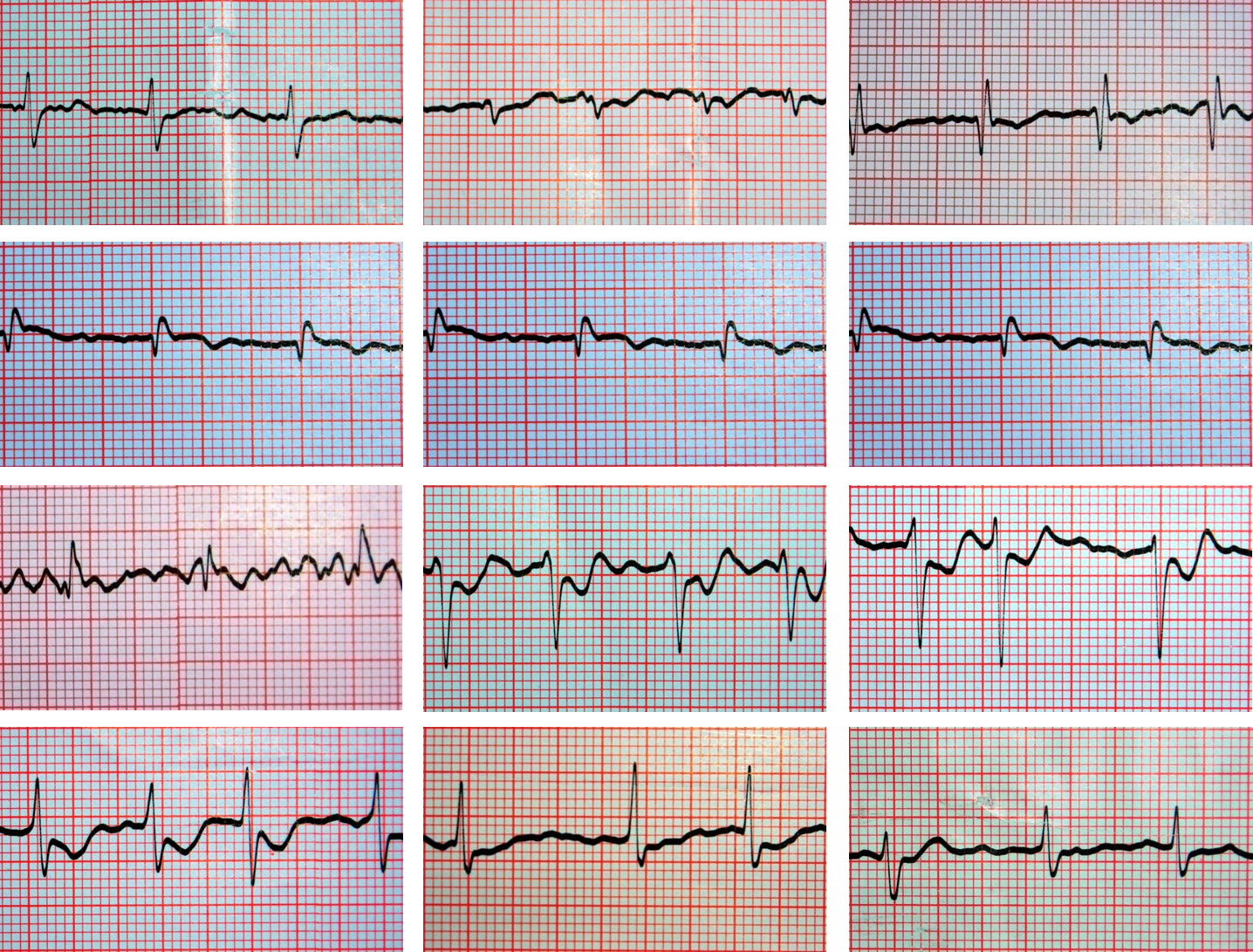 CARDIOLOGÍA: Casos Clínicos