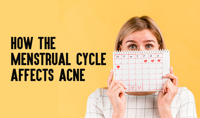 How the Menstrual Cycle Affects Acne