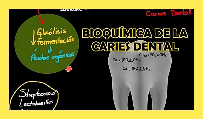 PDF: Bioquímica de la Caries Dental
