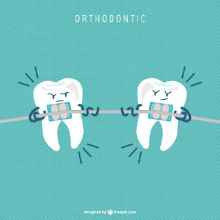 Sí, me he puesto ortodoncia vol.2: Mi primer mes con ortodoncia y mi primera revisión.