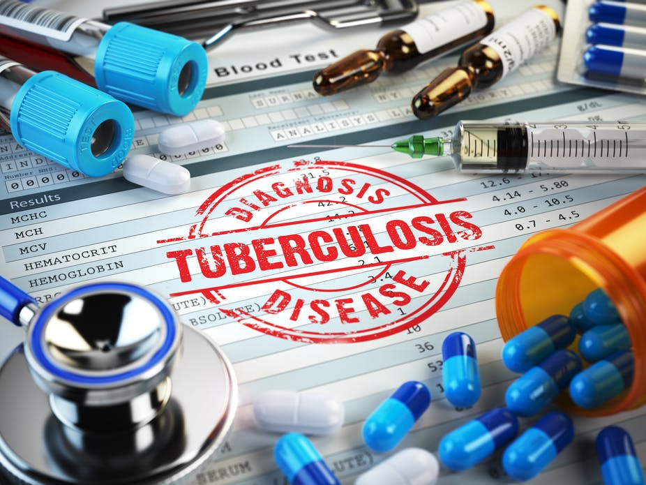 TB Test For UK Visa In Pakistan uk-tb-test-centre-in-india-tb-test-for-uk-visa-complete-process