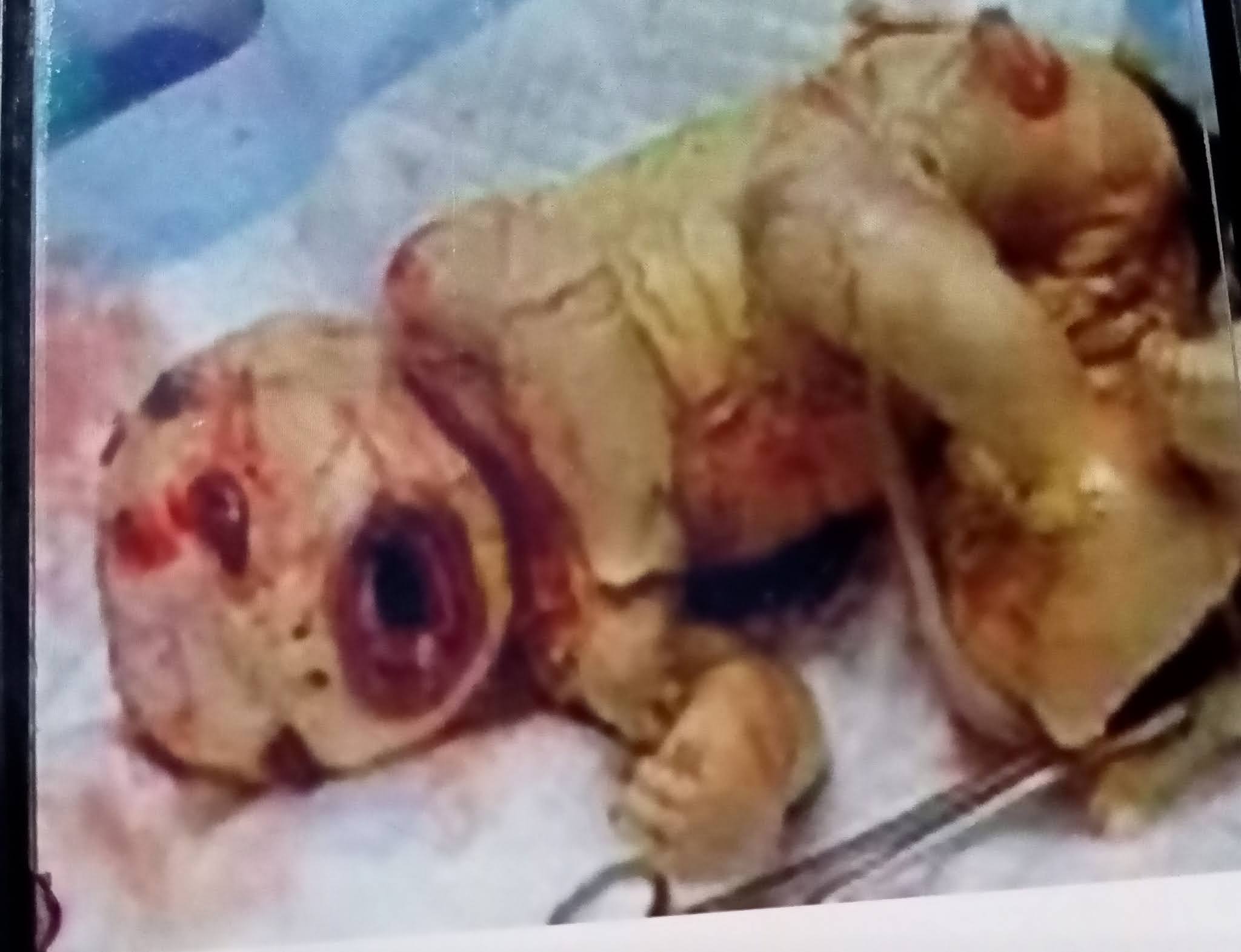 Neonatal harliquin (mysterious baby)