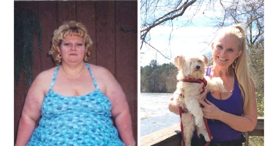 Ginger Rock, RN, BSN, CBN, BC Before and after weight loss surgery