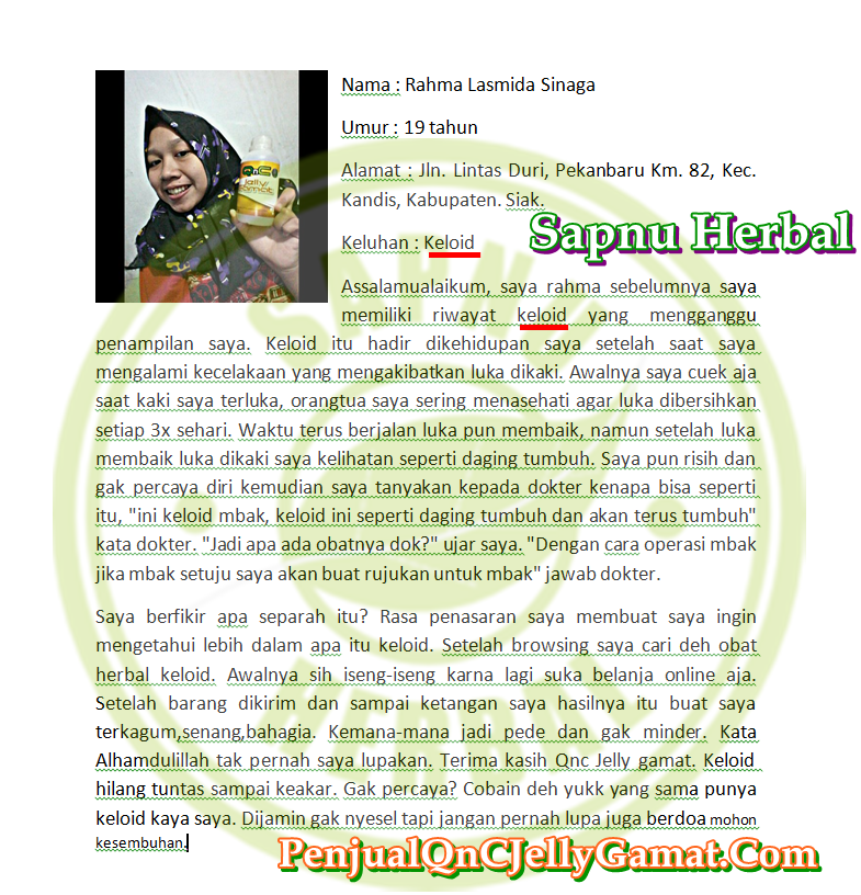 Cara Menghilangkan Keloid di Payudara Secara Alami dan Aman Cara Menghilangkan Keloid di Payudara Secara Alami dan Aman