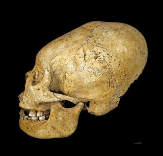 Proto Nazca deformed skulls, 200-100 BC
