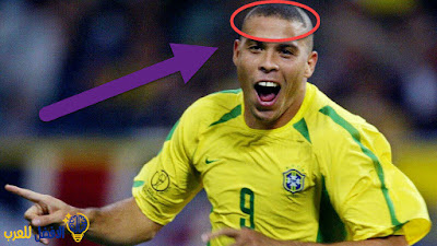 رونالدو Ronaldo الظاهرة كيف دمرته الإصابات اسطورة البرازيل قصة الشعر الغريبة